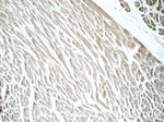 DIRAS1 Antibody in Immunohistochemistry (Paraffin) (IHC (P))