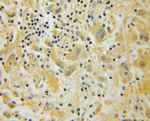 DIRAS1 Antibody in Immunohistochemistry (Paraffin) (IHC (P))