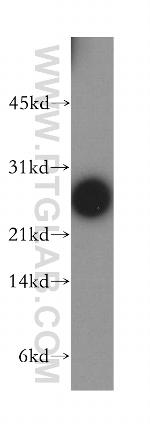 DIRAS1 Antibody in Western Blot (WB)