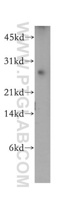 DIRAS1 Antibody in Western Blot (WB)