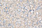 GNAO1 Antibody in Immunohistochemistry (Paraffin) (IHC (P))