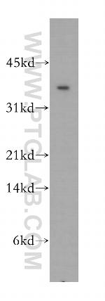 CIAPIN1 Antibody in Western Blot (WB)