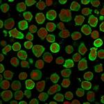 Calponin-1 (Smooth Muscle Marker) Monoclonal Antibody (CALP)