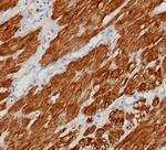 Calponin-1 (Smooth Muscle Marker) Recombinant Mouse Monoclonal Antibody (rCNN1/9164)