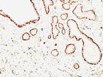Calponin-1 (Smooth Muscle Marker) Antibody in Immunohistochemistry (Paraffin) (IHC (P))