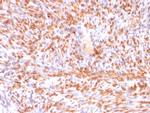 Calponin-1 Recombinant Mouse Monoclonal Antibody (rCNN1, 832)