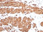 Calponin-1 (Smooth Muscle Marker) Recombinant Rabbit Monoclonal Antibody (CNN1/8870R)
