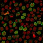 Calponin-1 Recombinant Rabbit Monoclonal Antibody (CNN1, 1408R)