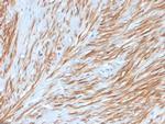 Calponin-1 Recombinant Rabbit Monoclonal Antibody (CNN1, 4227R)
