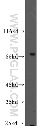 SHC4 Antibody in Western Blot (WB)