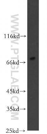 SHC4 Antibody in Western Blot (WB)