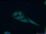 WDR16 Antibody in Immunocytochemistry (ICC/IF)