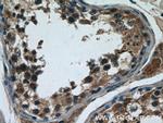 WDR16 Antibody in Immunohistochemistry (Paraffin) (IHC (P))