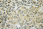 LANCL1 Antibody in Immunohistochemistry (Paraffin) (IHC (P))