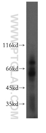 TCIRG1 Antibody in Western Blot (WB)