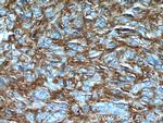 TMEM16A/DOG1 Antibody in Immunohistochemistry (Paraffin) (IHC (P))