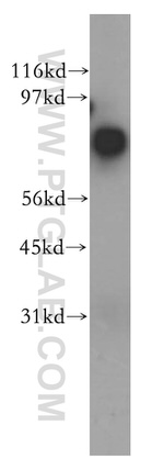 ARMC8 Antibody in Western Blot (WB)