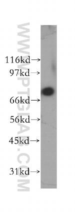 ARMC8 Antibody in Western Blot (WB)