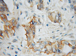 IL5RA Antibody in Immunohistochemistry (Paraffin) (IHC (P))