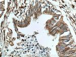 P4HA1 Antibody in Immunohistochemistry (Paraffin) (IHC (P))