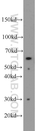 P4HA1 Antibody in Western Blot (WB)