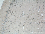 GPR155 Antibody in Immunohistochemistry (Paraffin) (IHC (P))
