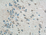 GPR155 Antibody in Immunohistochemistry (Paraffin) (IHC (P))