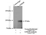 GPR155 Antibody in Immunoprecipitation (IP)