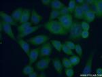 IkB beta Antibody in Immunocytochemistry (ICC/IF)