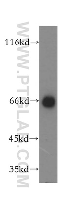 IMP5 Antibody in Western Blot (WB)