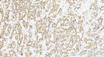 INPP4A Antibody in Immunohistochemistry (Paraffin) (IHC (P))