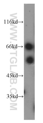 AGFG1 Antibody in Western Blot (WB)