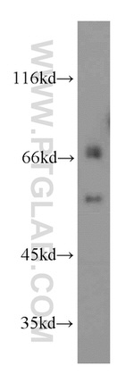 AGFG1 Antibody in Western Blot (WB)