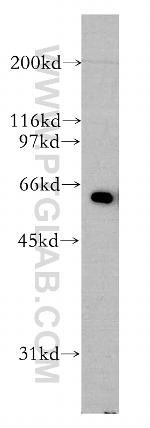 AGFG1 Antibody in Western Blot (WB)