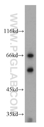 AGFG1 Antibody in Western Blot (WB)