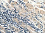 RHPN2 Antibody in Immunohistochemistry (Paraffin) (IHC (P))