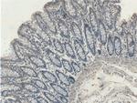 RHPN2 Antibody in Immunohistochemistry (Paraffin) (IHC (P))