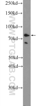 RHPN2 Antibody in Western Blot (WB)