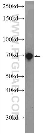 RHPN2 Antibody in Western Blot (WB)