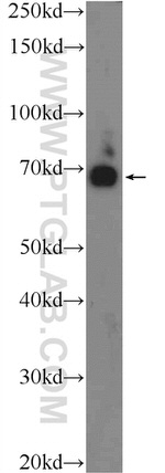 RHPN2 Antibody in Western Blot (WB)