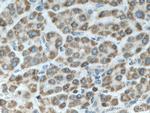 SHCBP1 Antibody in Immunohistochemistry (Paraffin) (IHC (P))