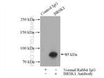 BRSK1 Antibody in Immunoprecipitation (IP)
