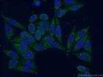 PPP2R5A Antibody in Immunocytochemistry (ICC/IF)
