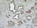 PPP2R5A Antibody in Immunohistochemistry (Paraffin) (IHC (P))