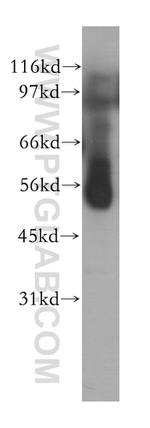 PPP2R5A Antibody in Western Blot (WB)