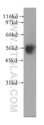 PPP2R5A Antibody in Western Blot (WB)