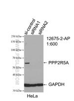 PPP2R5A Antibody in Western Blot (WB)