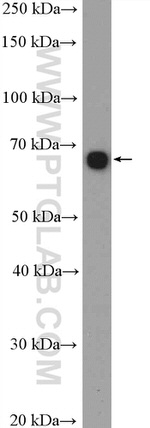 GLIS3 Antibody in Western Blot (WB)