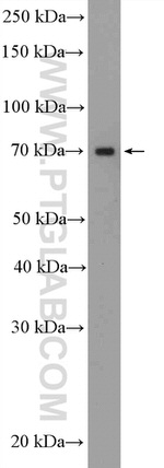 GLIS3 Antibody in Western Blot (WB)