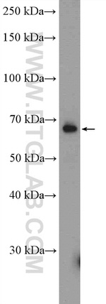 GLIS3 Antibody in Western Blot (WB)